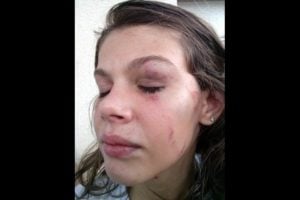 Quando a beleza dói