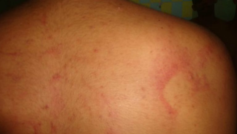 Tortura em interno