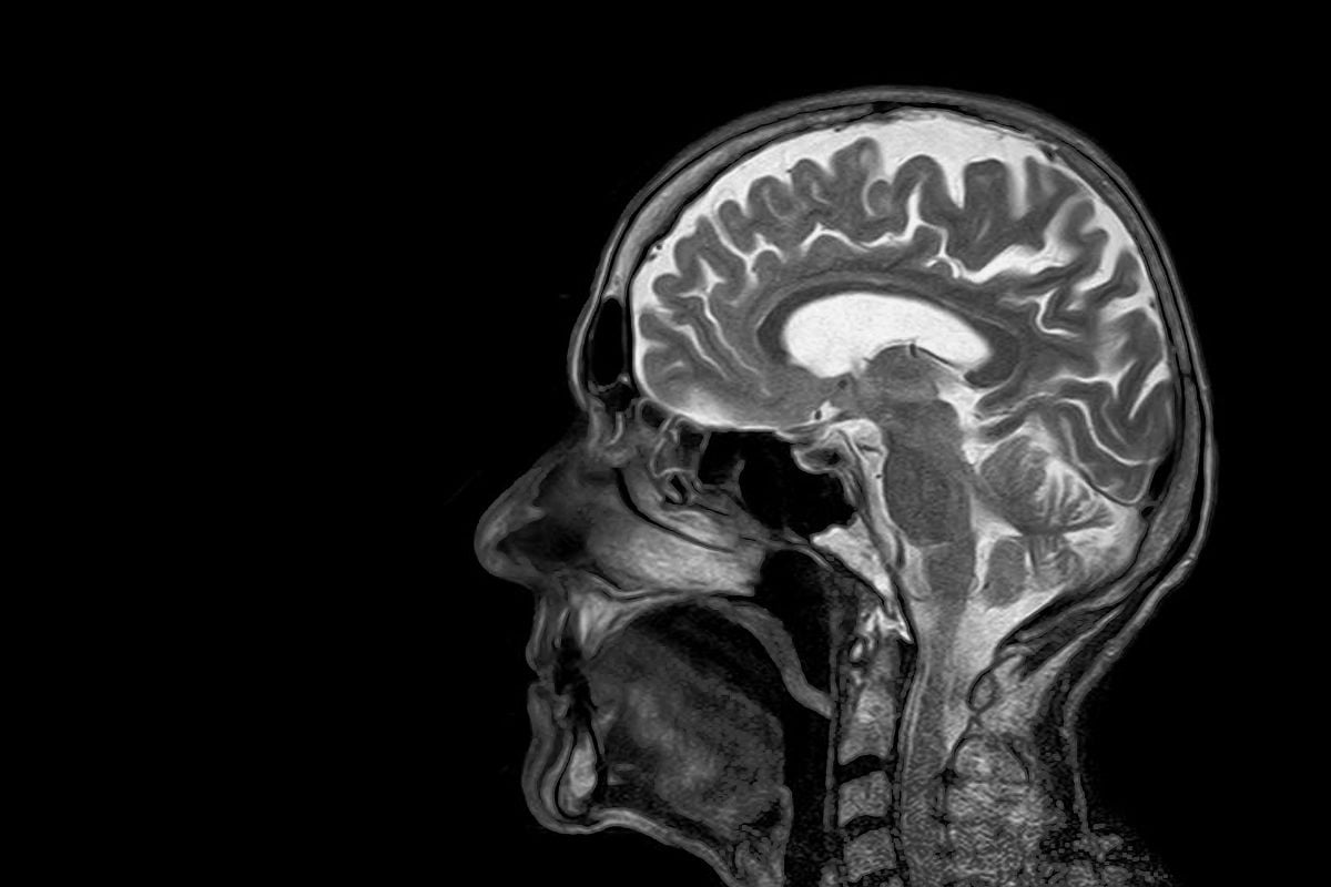 “Controle do avanço do Alzheimer pode estar próximo”