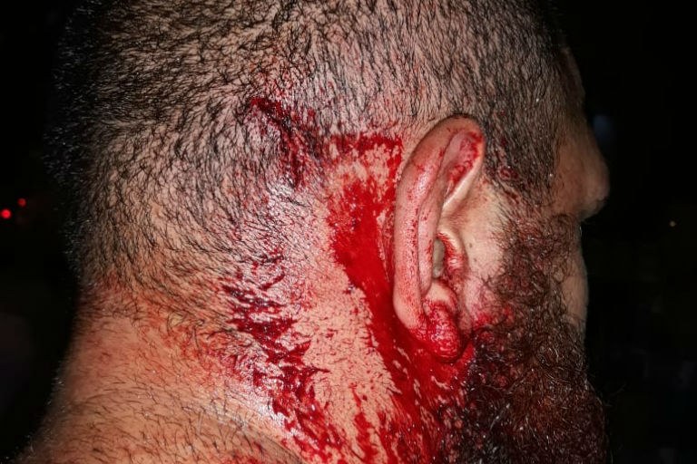 ONU se diz preocupada com violência em eleição no Brasil