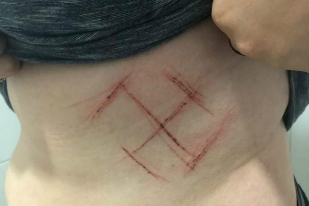 Jovem é agredida e marcada com suástica por vestir camisa “Ele Não”