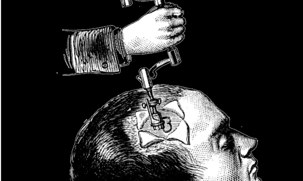 Antes da anestesia, a medicina era um ofício sem misericórdia
