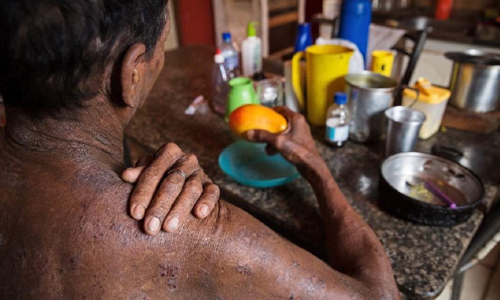 Trabalhadores da fruticultura não ganham para vida digna, diz estudo