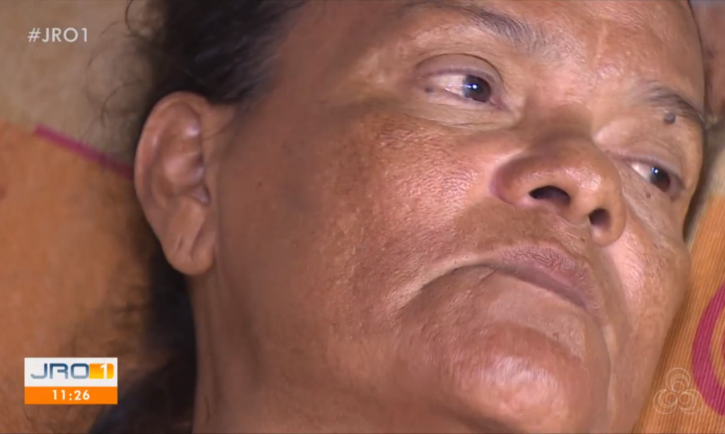 Mulher sem mãos e pernas teve benefício negado por não assinar papel