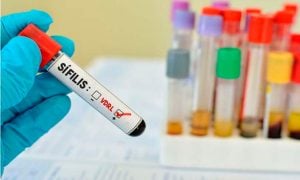 Sífilis: uma epidemia fora de controle