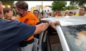 Senador Cid Gomes é baleado durante manifestação no Ceará