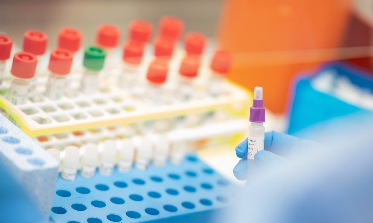 Novo estudo sobre cloroquina contra coronavírus gera fortes receios de cientistas