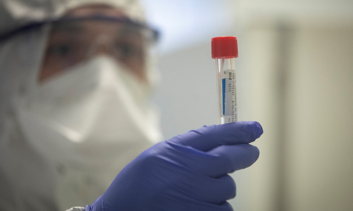 Número de contaminados por coronavírus no mundo passa de 100 mil