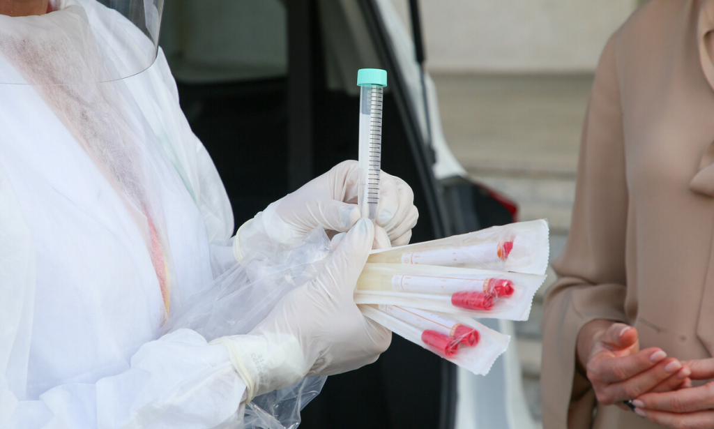 Nova regra impõe que planos de saúde cubram testes para covid-19