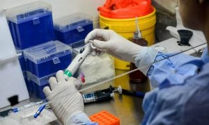 Brasil supera os 2 milhões de casos de coronavírus
