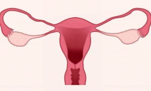Câncer de colo para pessoas com vagina: o que você precisa saber