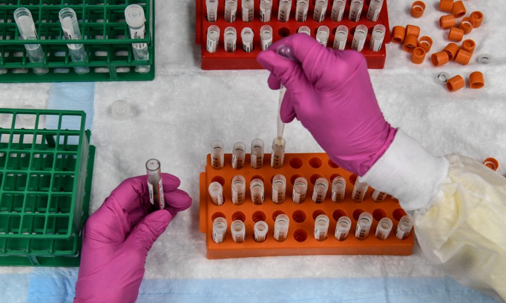 Oxford retoma testes de vacina contra a Covid-19