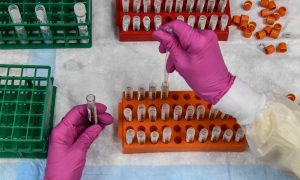 Vacina russa não pode ainda ser aplicada em toda população, diz infectologista