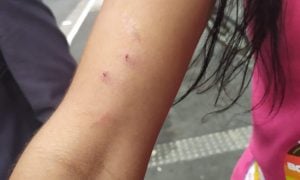 Mulher trans é agredida com bastão de ferro durante campanha eleitoral em SP