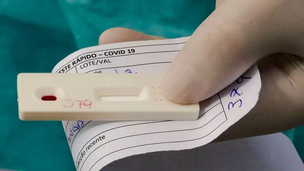 Anvisa aprova segundo autoteste para Covid-19
