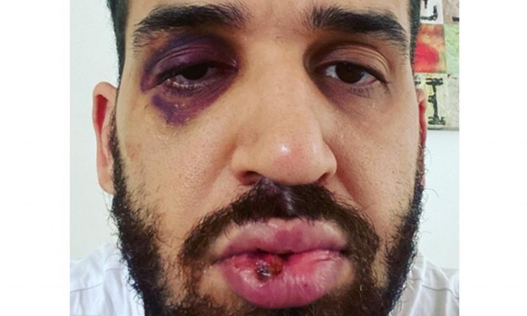 Médico é agredido ao tentar convencer parente a não ir à festa