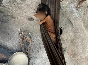 Nove crianças Yanomami morrem por falta de atendimento em dois meses, diz associação