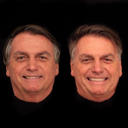 Cercado em investigações sobre joias, Bolsonaro faz ‘harmonização’ dental de quase R$ 100 mil