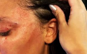 Mulher é agredida após usar banheiro feminino e ser confundida com trans em restaurante