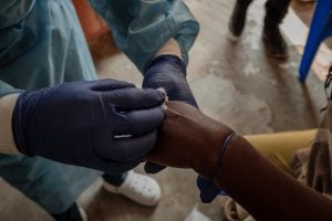 Vacina brasileira contra a mpox está próxima dos testes em humanos
