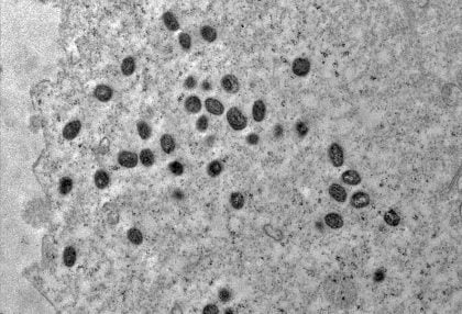 Mpox deixa de ser emergência de saúde internacional, anuncia a OMS
