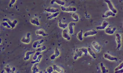 Testes confirmam que ameba rara causou morte de criança no Ceará