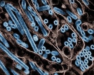 Surto de gripe aviária é detectado perto de Lisboa