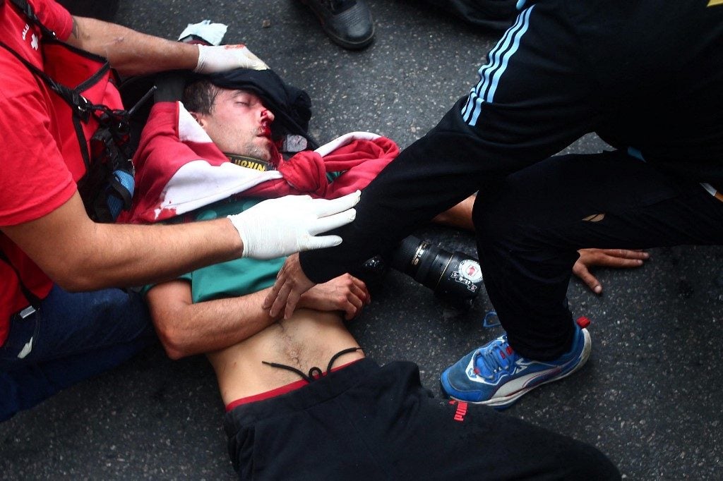 Jornalista está em estado crítico após repressão policial em protesto na Argentina