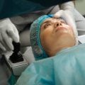 5 mitos comuns sobre a cirurgia de catarata