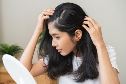 Veja as causas e os tratamentos para a alopecia areata