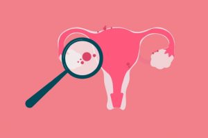 5 motivos para ir ao ginecologista regularmente