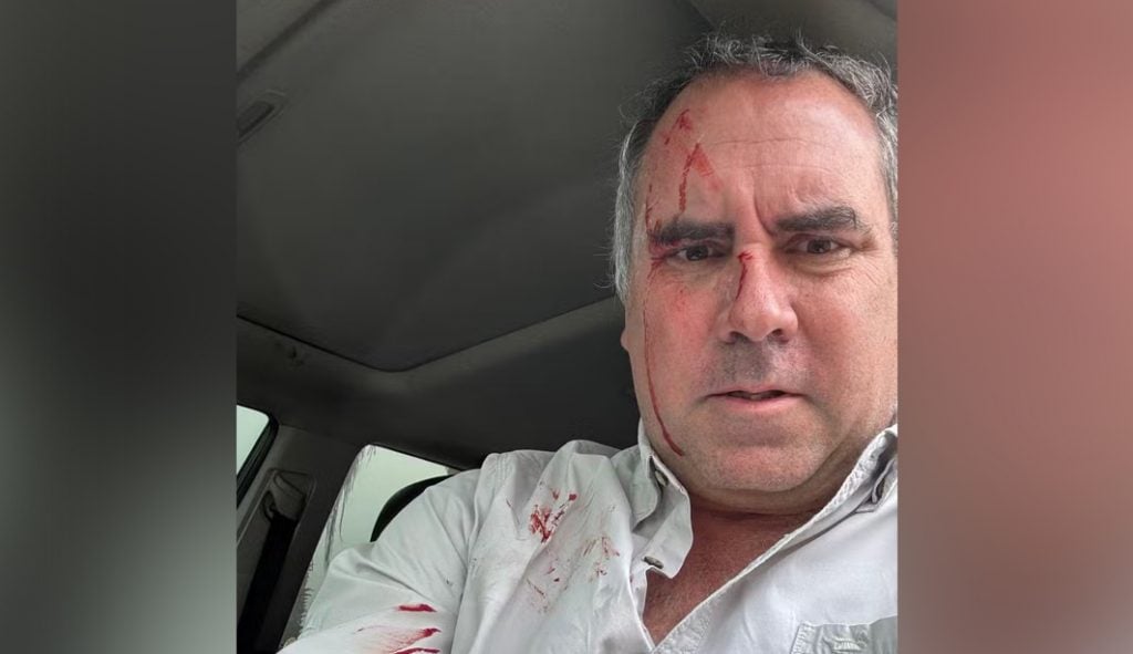 Pré-candidato à Presidência do Peru sai ileso de ataque a tiros