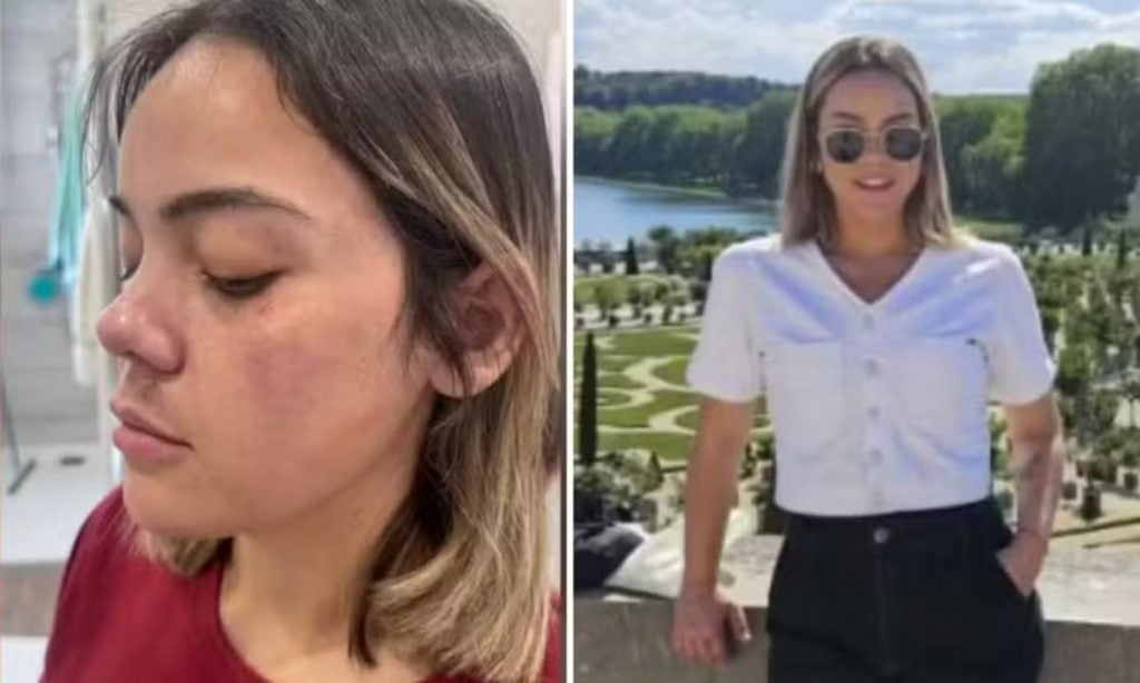 Brasileira vítima de tentativa de estupro em Paris é ouvida pela primeira vez por Justiça francesa