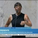 Deputada bolsonarista da Alesp usa ‘blackface’ em ataque a Erika Hilton