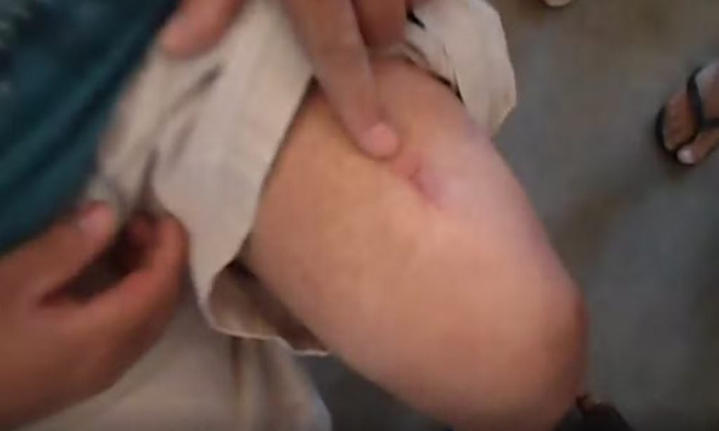 Justiça condena estado de SP a indenização de R$ 258 mil por tortura contra detentos