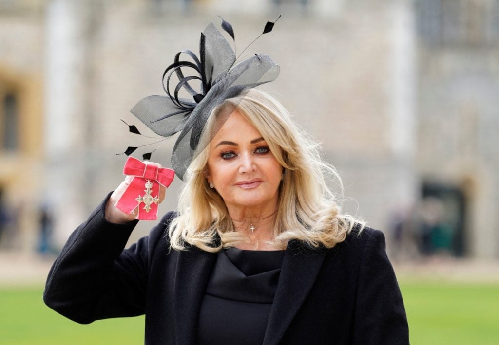 Cantora Bonnie Tyler, de ‘Total Eclipse of the Heart’, está em coma induzido após cirurgia