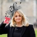 Cantora Bonnie Tyler, de ‘Total Eclipse of the Heart’, está em coma induzido após cirurgia