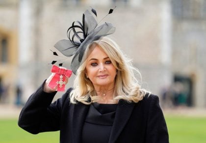 Cantora Bonnie Tyler, de ‘Total Eclipse of the Heart’, está em coma induzido após cirurgia