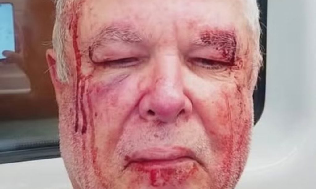 Polícia investiga agressão a idoso em Copacabana por suposta motivação política