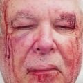 Polícia investiga agressão a idoso em Copacabana por suposta motivação política