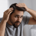 Eflúvio telógeno: veja a causa da queda de cabelo após infecções e o que fazer