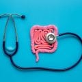 Síndrome do Intestino Irritável: entenda como as emoções podem desencadear os sintomas 